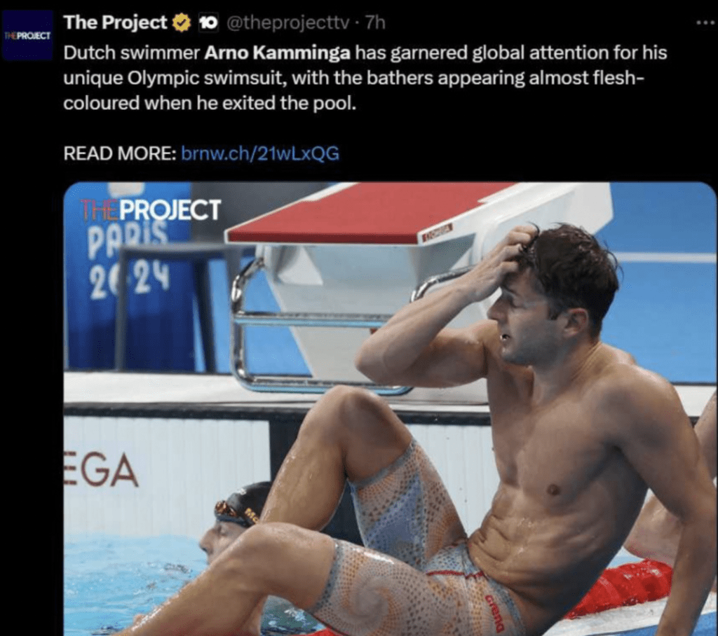 现年28 岁的阿诺卡明加因一条泳裤而“一举成名”，备受媒体关注报道。