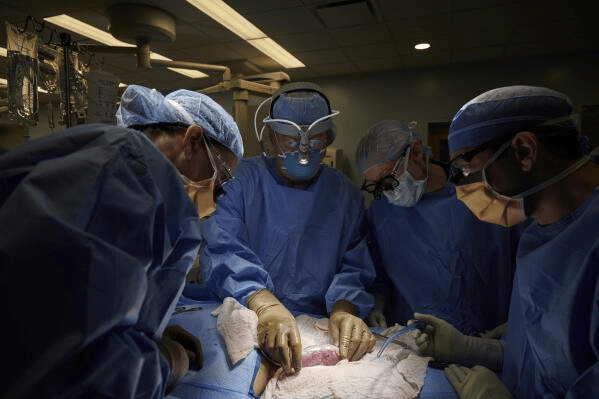 纽约大学的外科医生将猪肾移植到一名脑死亡的人体内，一个多月以来，它一直正常工作。AP