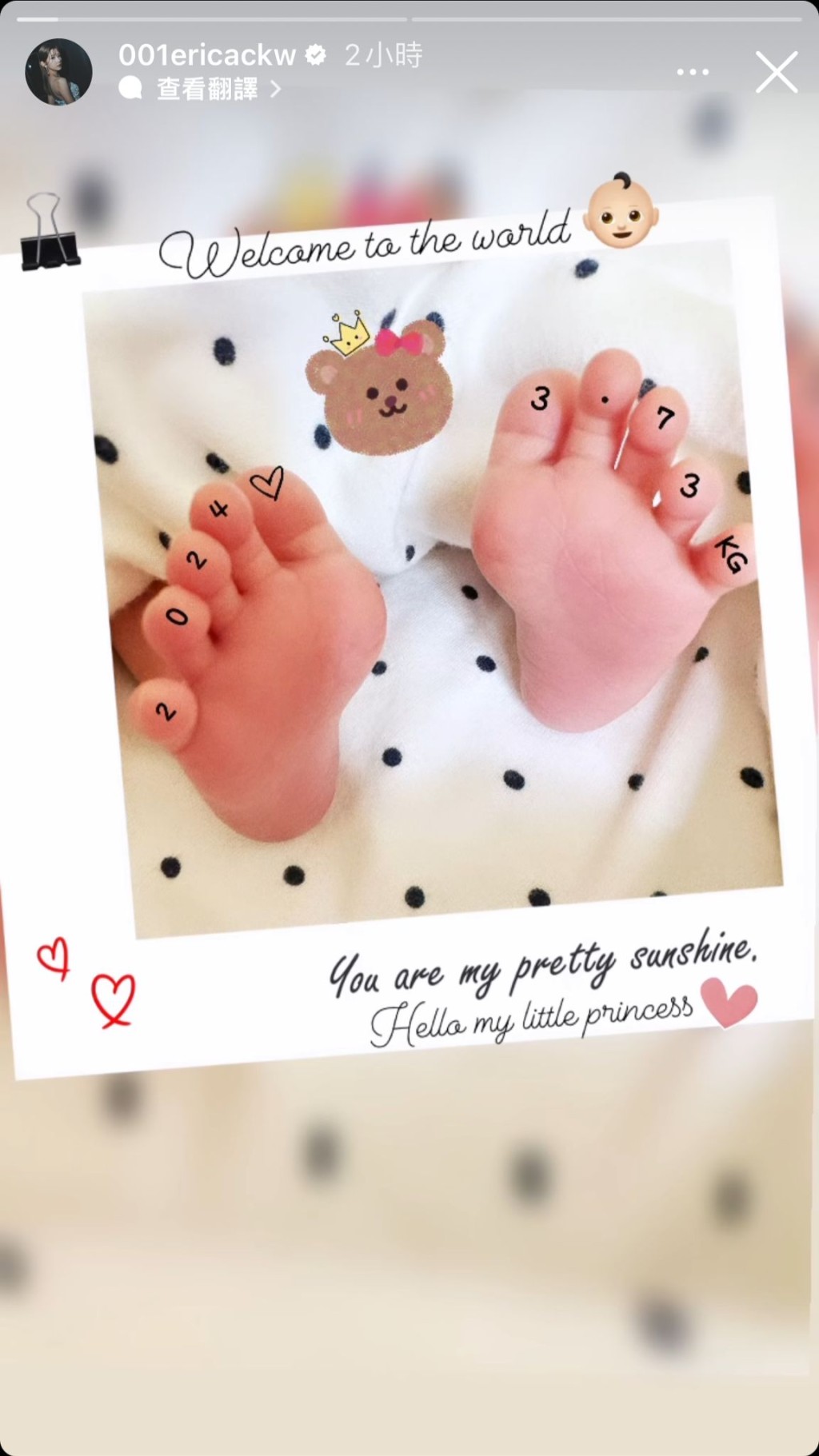 陈嘉慧今日（18日）在IG限时动态贴两张BB的脚仔相，宣布小公主已经诞生了