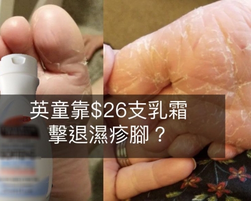 男童使用的平價保濕乳霜,令腳板不再龜裂。(網上圖片)