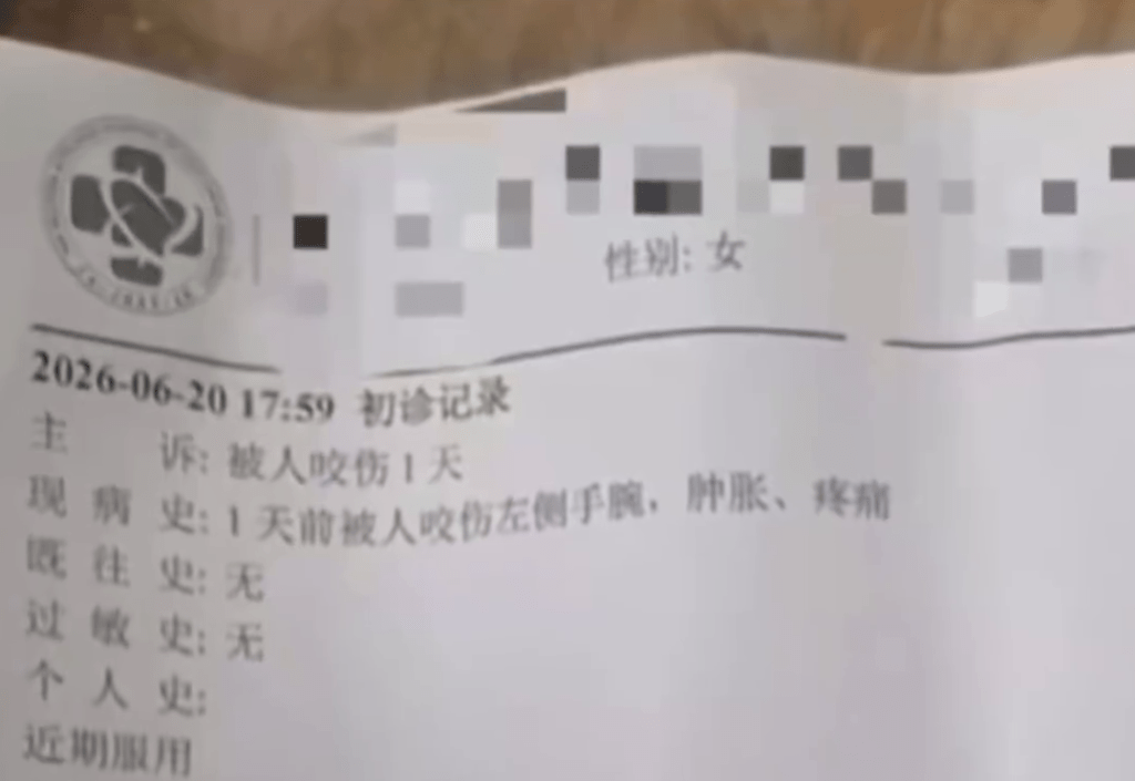 诊疗记录注明被人咬伤。