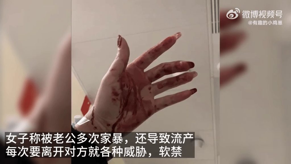 女子展示受傷後滿手鮮血的照片。