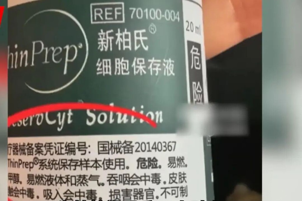 用於檢測的「新柏氏細胞保存液」。浪潮新聞 用於檢測的「新柏氏細胞保存液」。浪潮新聞
