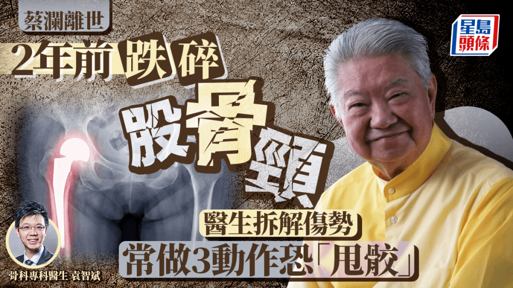 蔡瀾離世｜兩年前曾跌碎股骨頸 醫生拆解傷勢 常做3動作恐「甩骹」