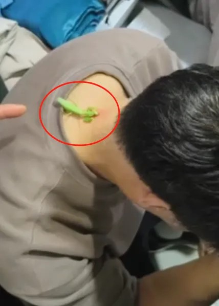 影片拍摄者声称，用螳螂来食颈疣这偏方在河南老一辈很多人知道。影片截图