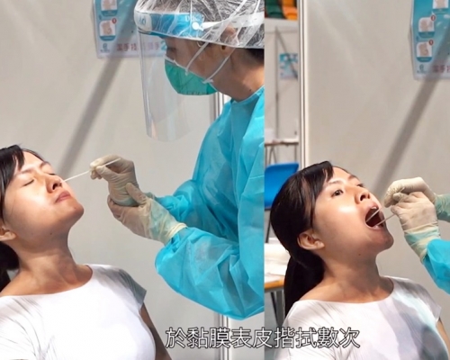 人員會將兩支拭子,分別伸入兩邊鼻腔約1-2厘米深的位置,和伸入喉嚨於黏膜表皮揩拭數次。片段截圖