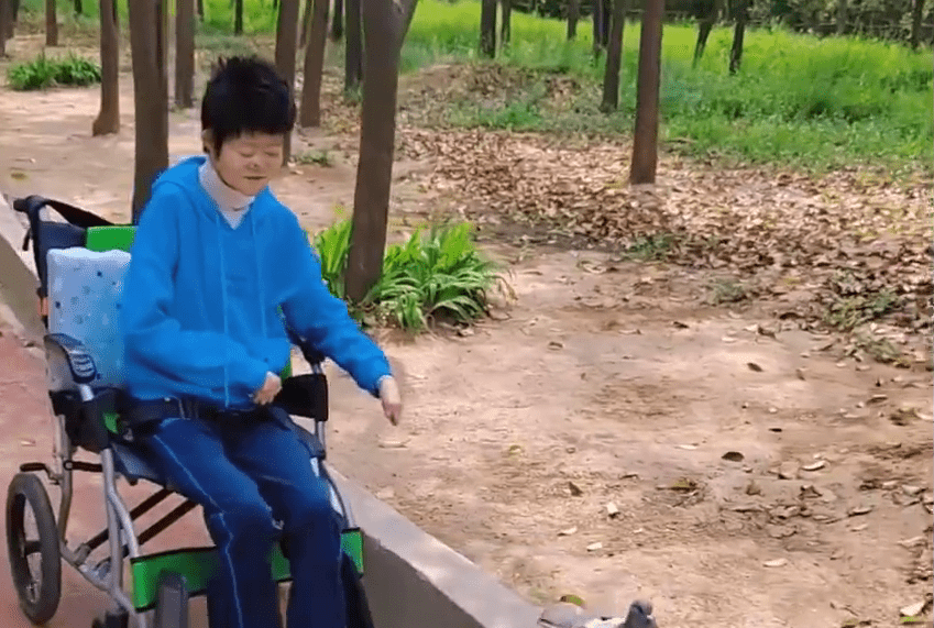 高尚好是內地首位接受分指手術的「蝴蝶寶貝」。 高尚好是內地首位接受分指手術的「蝴蝶寶貝」。