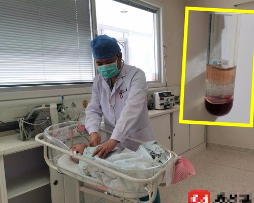 醫護人員早前為小楊楊抽血時，竟意外抽出「牛奶血」。網圖
