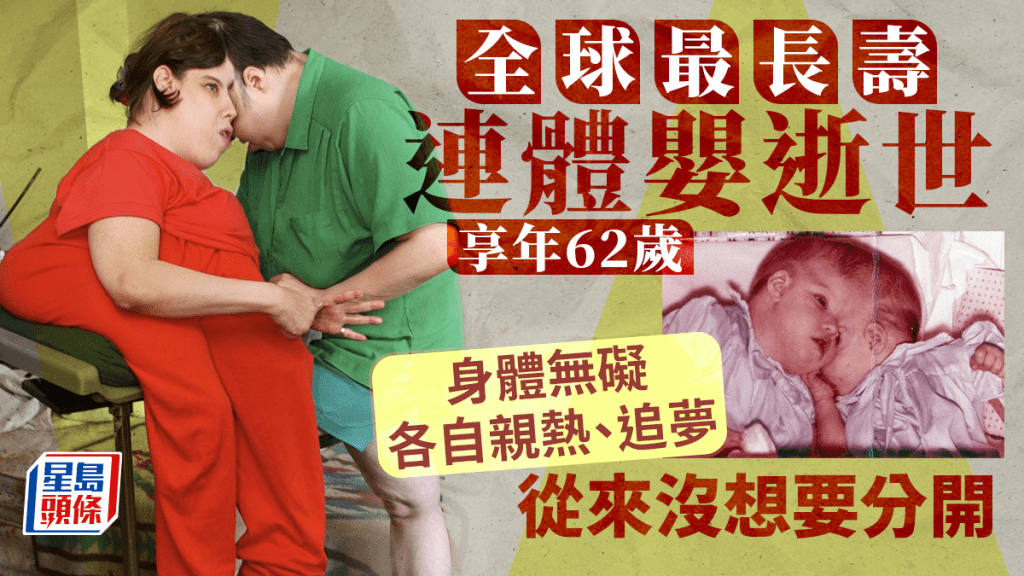 全球最長壽連體嬰蘿莉和喬治逝世，享年62歲。 美聯社