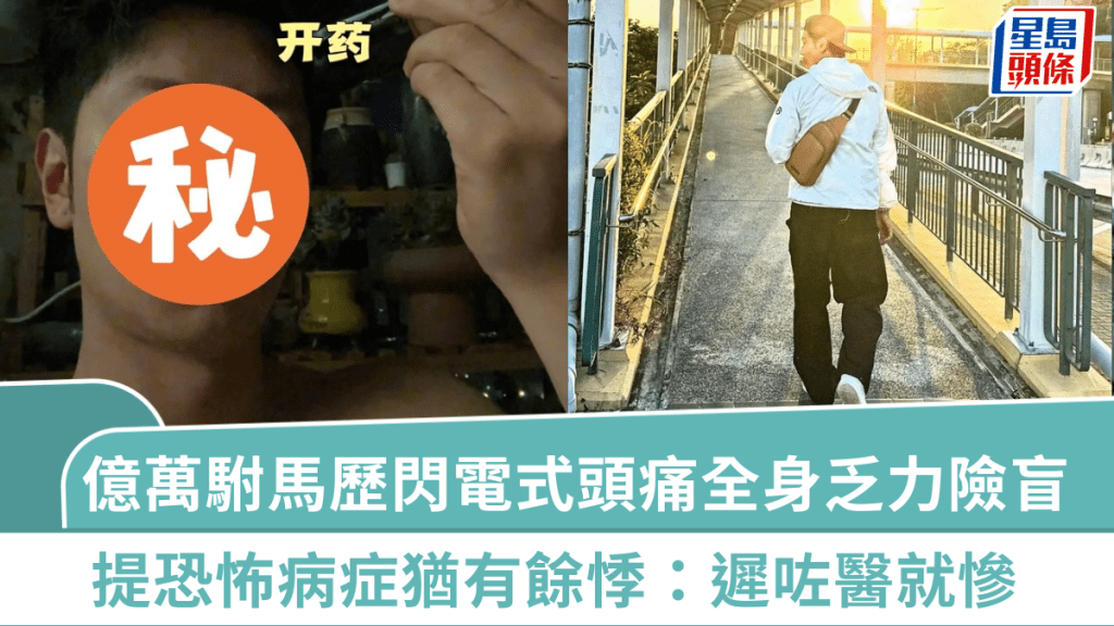 41歲「億萬駙馬」歷閃電式頭痛全身乏力險盲  提恐怖病症猶有餘悸：遲咗醫就慘