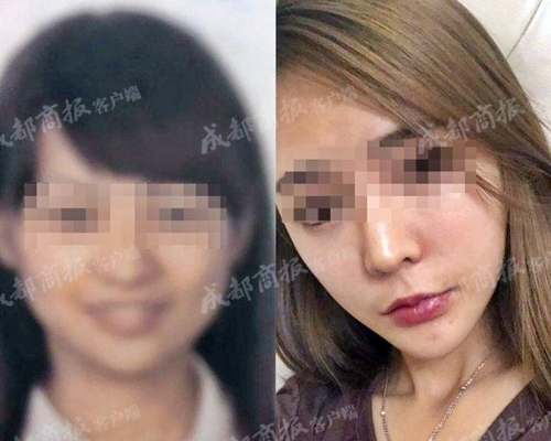 成都女子因容貎差別太大,被拒登機。