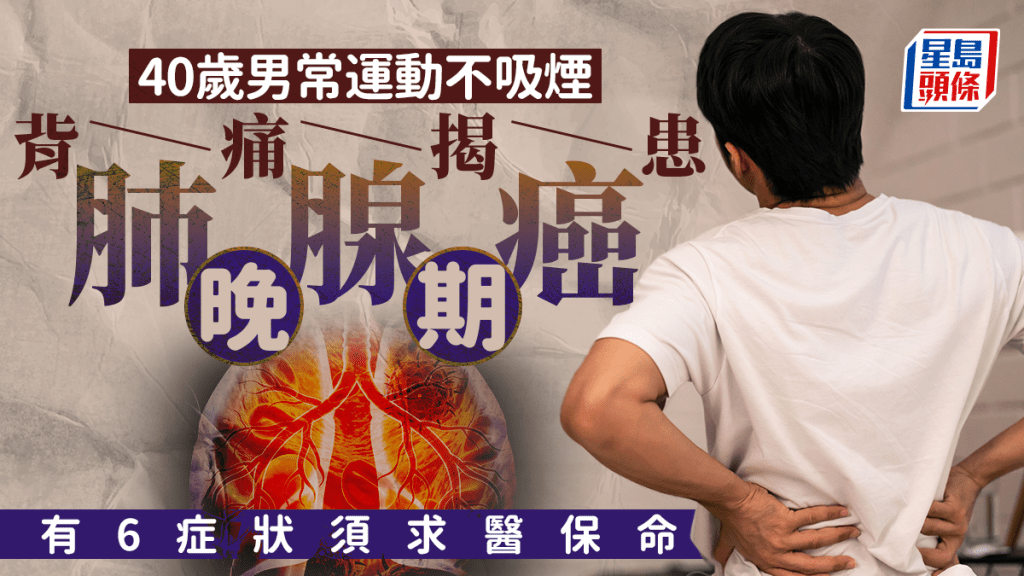 肺癌｜40歲男常運動不吸煙 背痛揭患肺腺癌晚期 出現6症狀須求醫保命