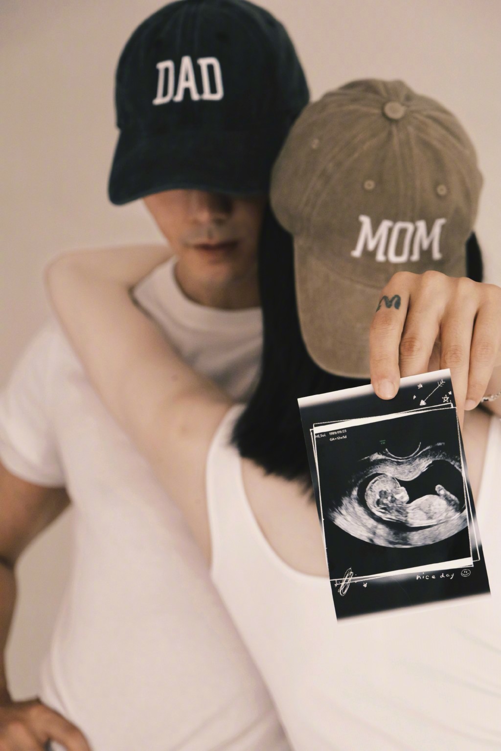 更在社交平台大晒BB照聲波照片。