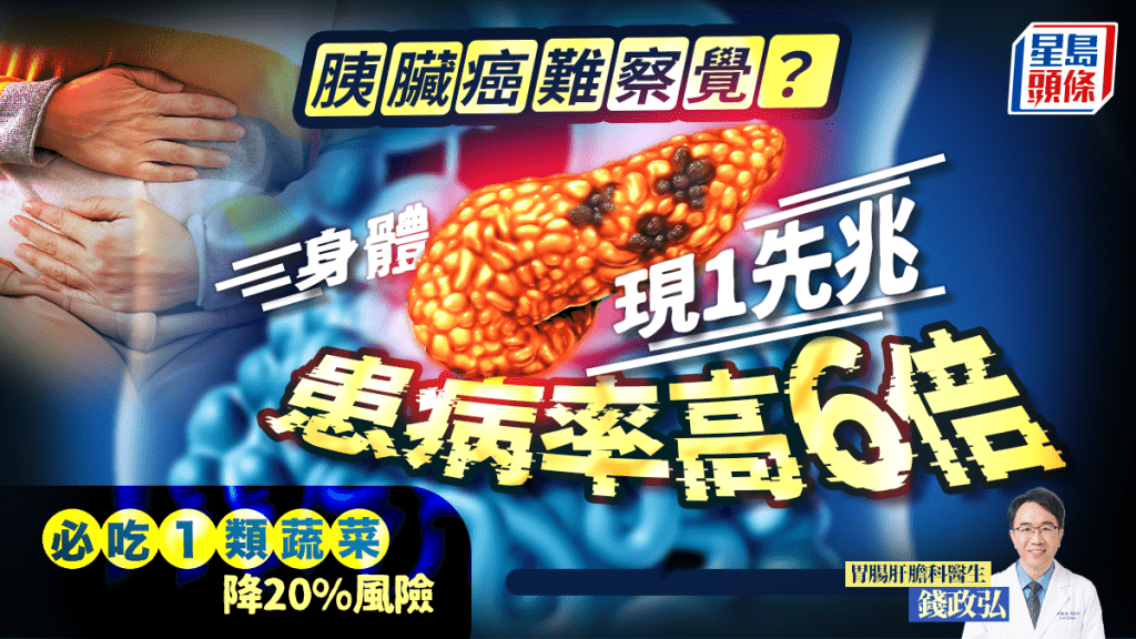 胰臟癌難察覺？身體現1先兆患病率高6倍 醫生教必吃1類蔬菜降20%風險