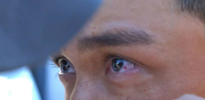 左眼出现红点。