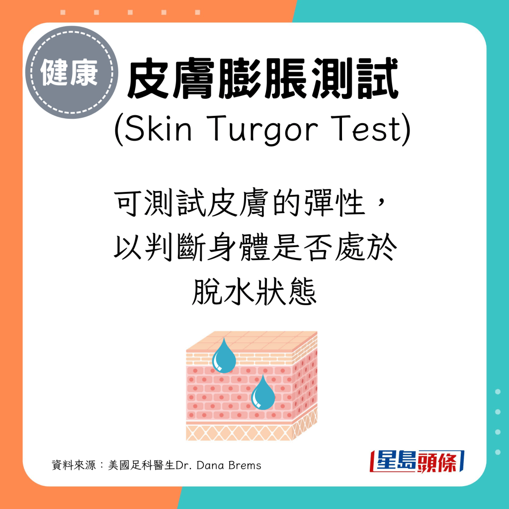 皮膚膨脹測試：可測試皮膚的彈性，以判斷身體是否處於脫水狀態