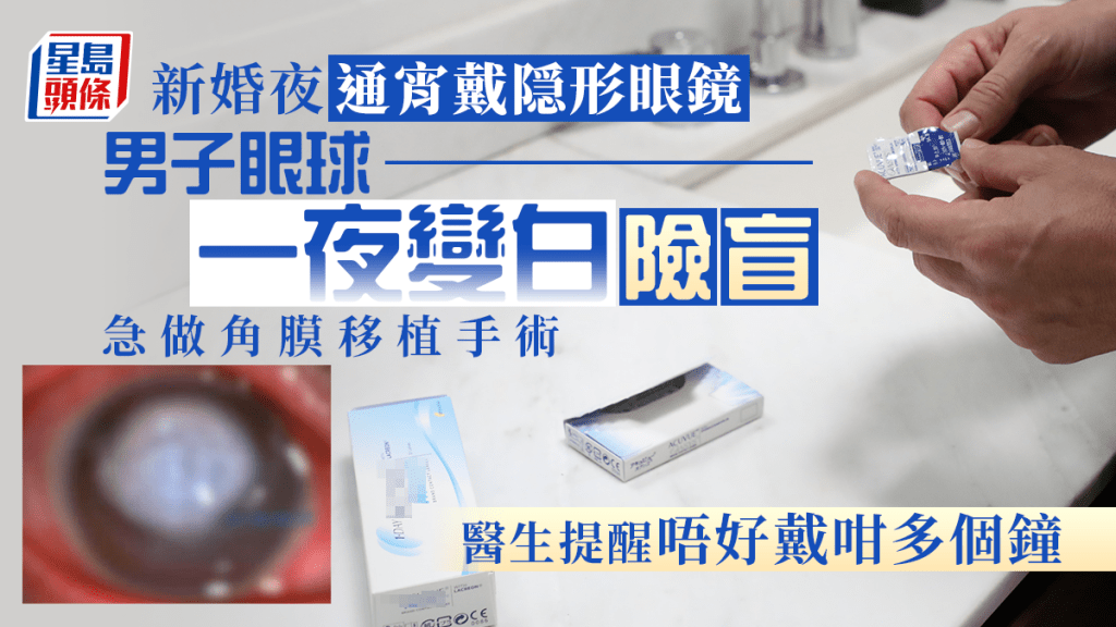 醫生提醒不應佩戴隱形眼鏡超過8小時。網上圖片