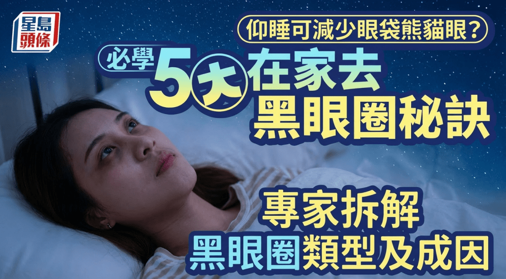 仰睡可減少眼袋熊貓眼？專家拆解黑眼圈類型及成因 必學5大在家去黑眼圈秘訣