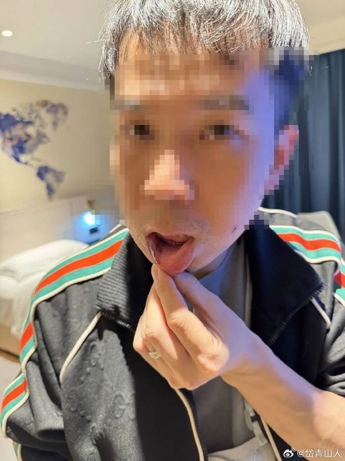 “铁铁”展示伤口。