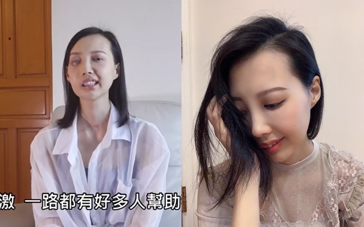 李明蔚早前在網上募捐醫藥費，得以接受新治療法，完成首個療程後感覺有好轉。