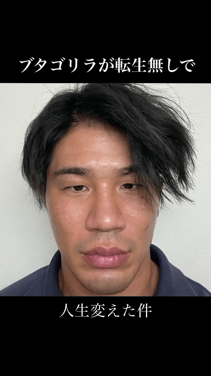 日丑男被骂“猪狒狒”饱受欺凌,狂操肌兼整容逆袭成“神户型男”。 日丑男被骂“猪狒狒”饱受欺凌,狂操肌兼整容逆袭成“神户型男”。