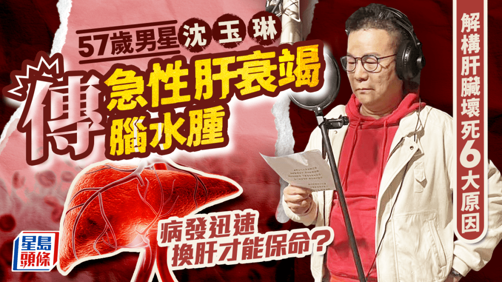 57歲男星傳急性肝衰竭腦水腫 解構6大成因 病發迅速/致命併發症多 換肝才能保命?