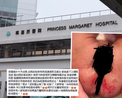 初生女嬰母親發帖，質疑護士換片不足，致女兒屁股受損。資料圖片/ fb群組「巴打絲打Facebook Club」