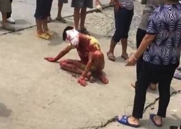 一名傷者坐在地上,血流披臉,全身染血。(網圖)