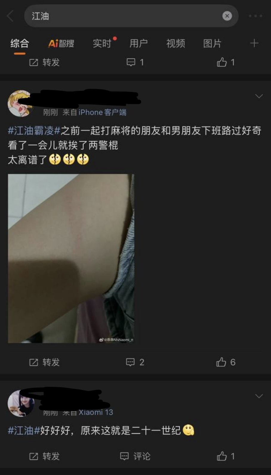 警方武力驅散聲援賴姓少女的民眾展示傷痕。X 警方武力驅散聲援賴姓少女的民眾展示傷痕。X