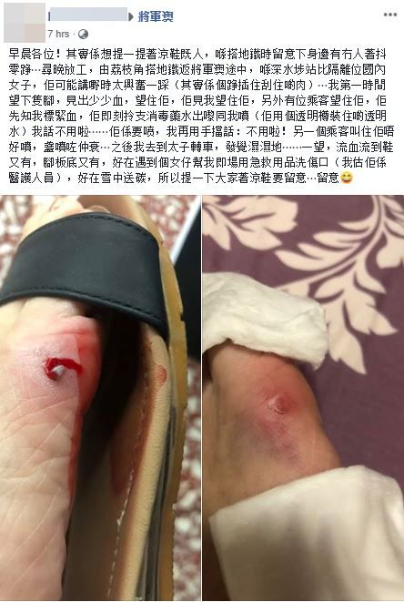 樓主提醒大家穿涼鞋外出時要特別留意。fb群組「將軍澳」