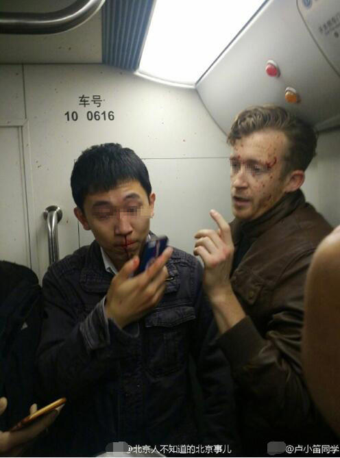 該青年被打至鼻孔流血,而外國男子臉上亦有血。