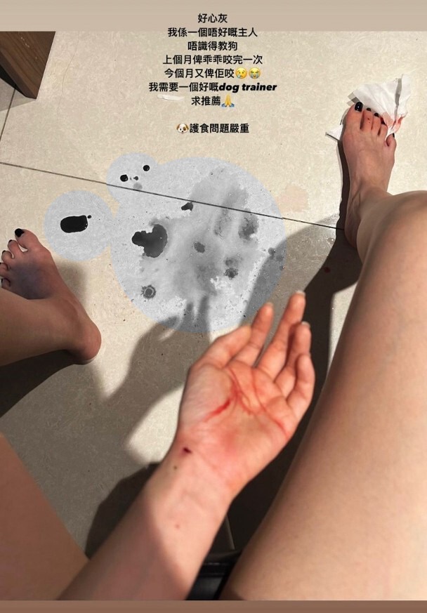 陳若思日前在IG限時動態上載多張相片，本來見到她一雙白滑美腿非常吸引，但前方卻有一攤血漬，腳上踏住一張染血紙巾，狀甚恐怖。  ​