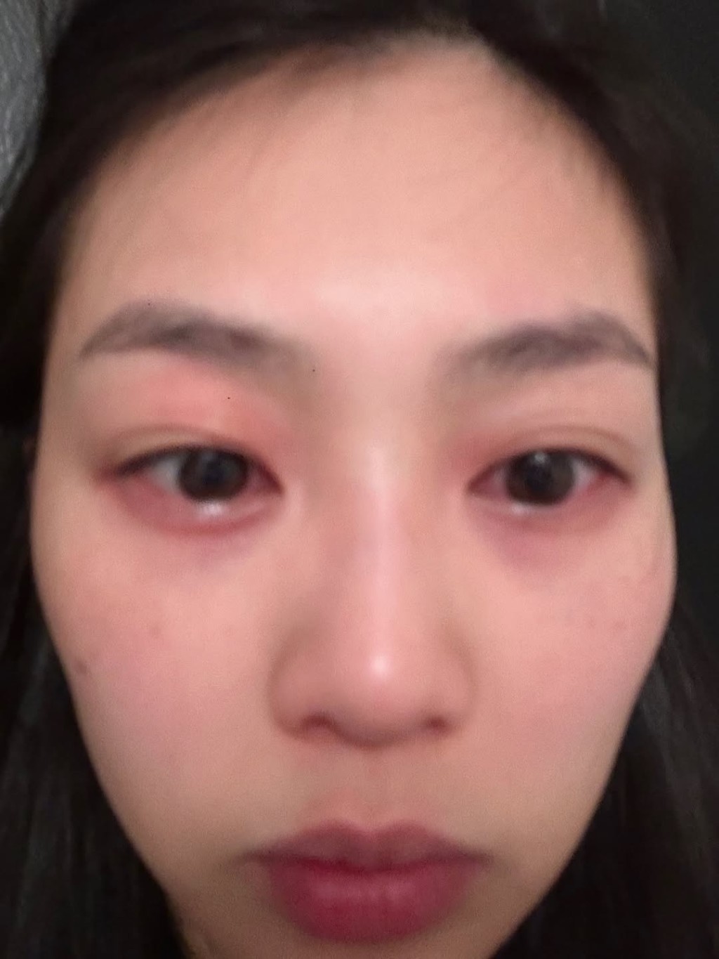 郭柏妍雙眼極為紅腫。 郭柏妍雙眼極為紅腫。