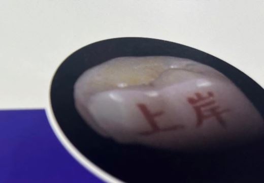 內地社交平台有不少年輕人對「牙齒紋身」有興趣。抖音@上游新聞