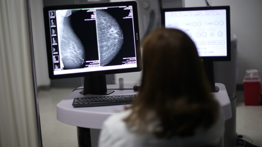一名腫瘤科醫正生在進行乳房X光檢查。 新華社