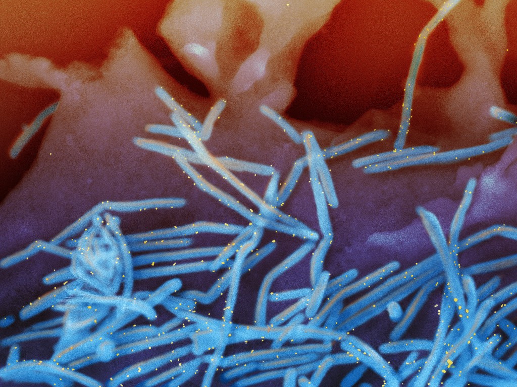 显微镜图像显示人类呼吸道合胞病毒 (RSV)。美联社