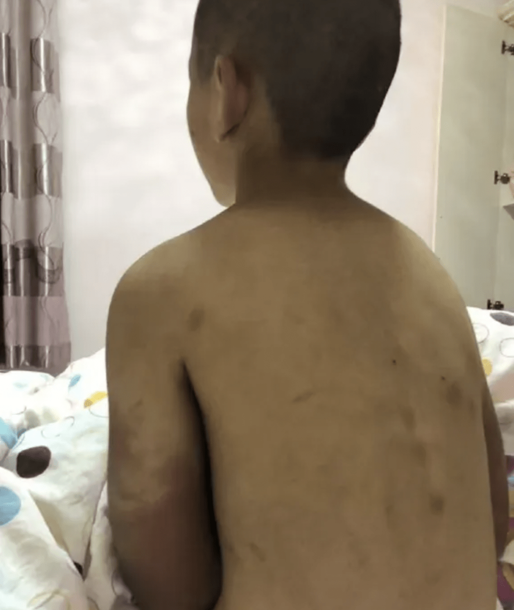 根據警方的說法，張砷長期被虐待、不給飯吃。微信公眾號截圖