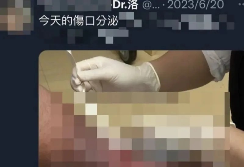 洪姓男疑犯在网上假扮医生，将女病患隐私照片公开。网络图片