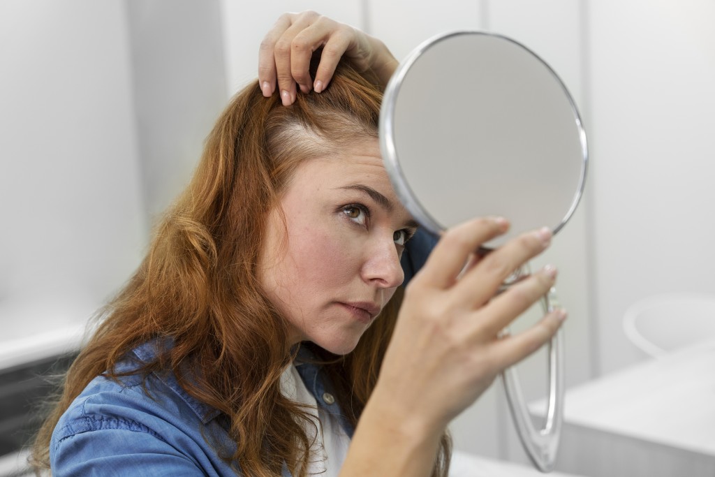 医学界相信，斑秃是由于免疫系统失调，导致身体产生不正常的抗体，攻击毛囊细胞，令受影响位置的毛发，可在数天或数星期内脱落至光秃。（图片来源：freepik）
