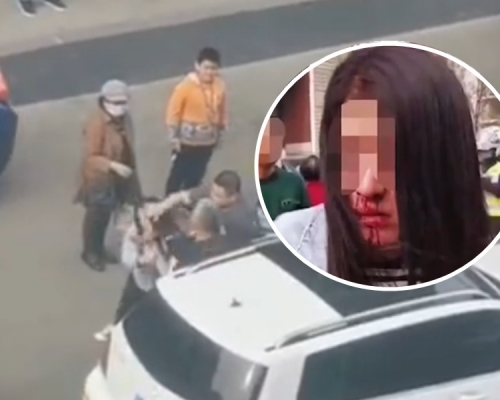 騎電單車母子被私家車開門撞倒,女子反被以為刻意碰瓷遭毆打至鼻血直流(小圖)。影片截圖