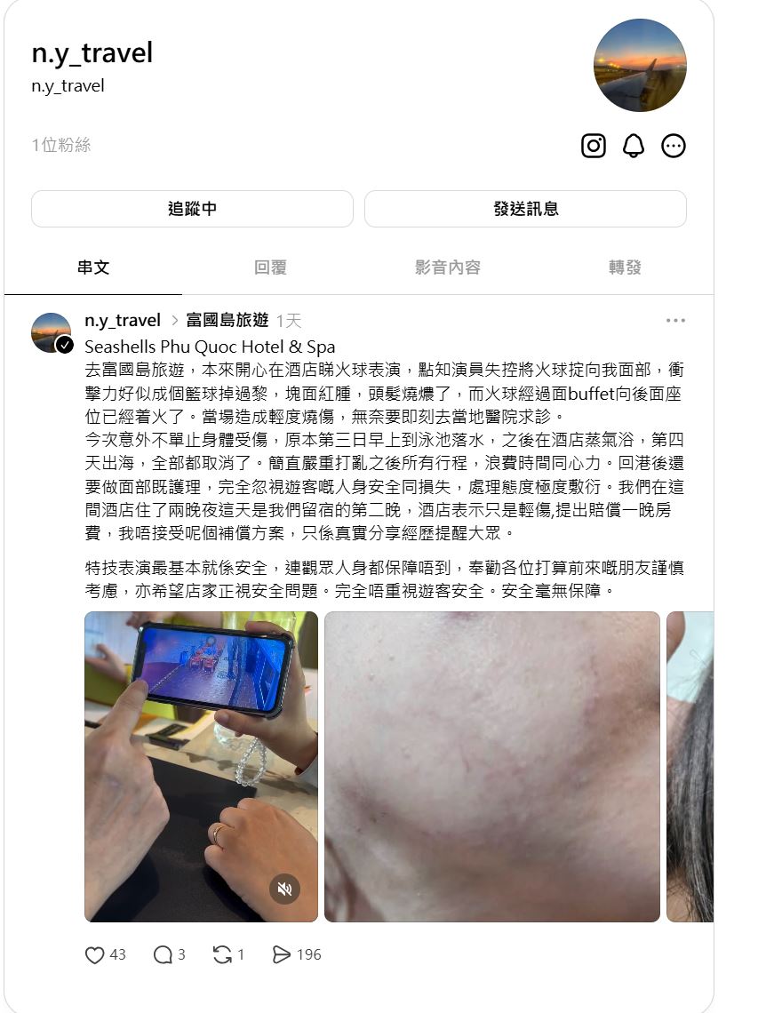 有港人到越南富國島看酒店的火舞表演，被火球擊中受傷燒焦頭髮。Threads@n.y_travel