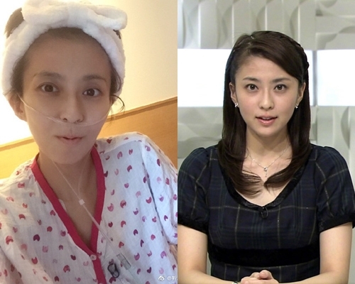 小林麻央因癌症離世，享年34歲。