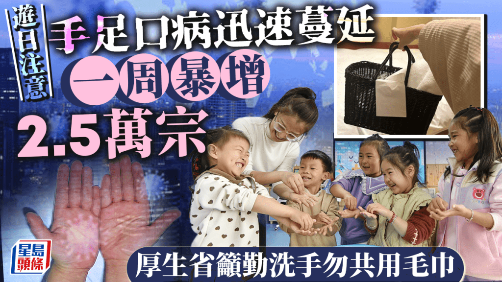 日本爆發手足口病疫情,官方提醒民眾及遊客切勿共用毛巾。