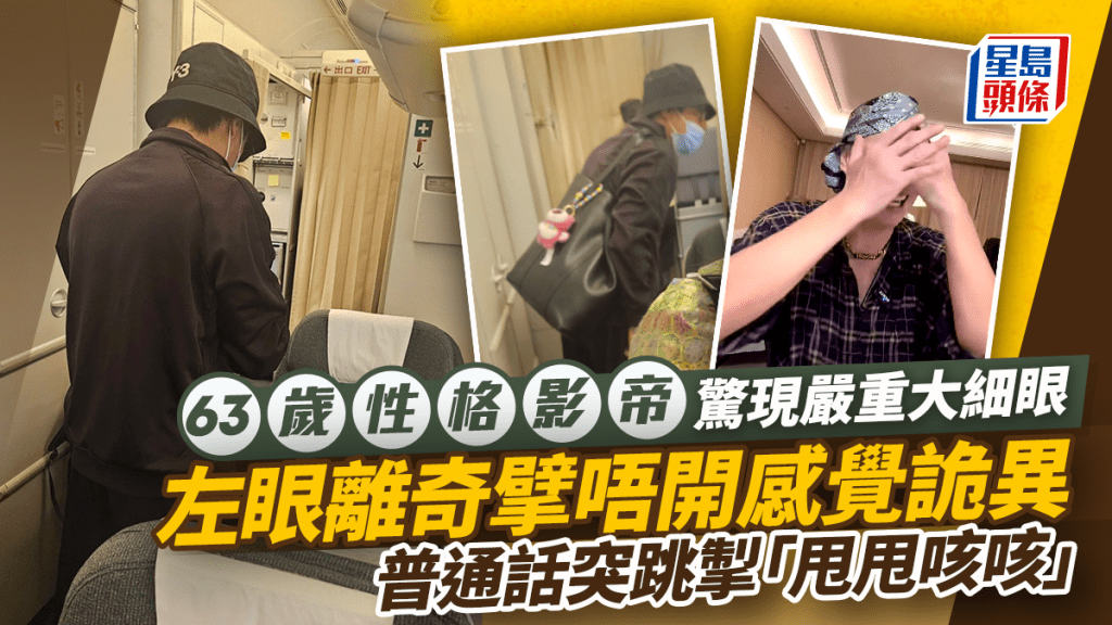 63歲性格影帝驚現嚴重大細眼 左眼離奇擘唔開感覺詭異 普通話突跳掣「甩甩咳咳」