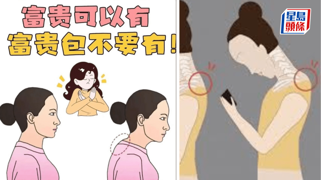 「富貴包」不可以有。