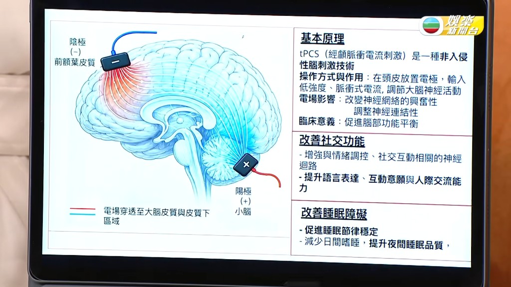 張致恒兒子現正接受的「經顱脈衝電流刺激」運作原理。(影片截圖:《流行都市》) 張致恒兒子現正接受的「經顱脈衝電流刺激」運作原理。(影片截圖:《流行都市》)