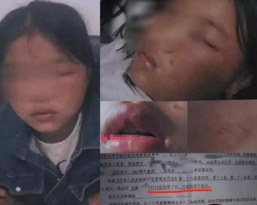 13歲女童遙遙遭8人欺凌3小時,被迫剪頭髮,又遭剝光衣服拍裸照,身上傷痕纍纍。(網圖)