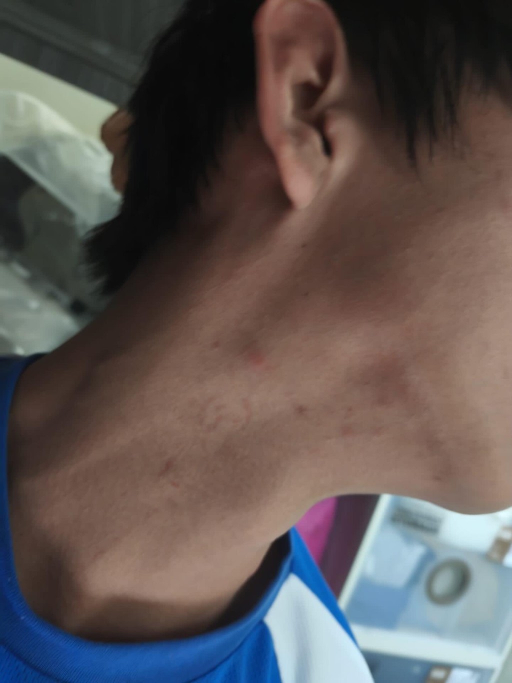 男童的脚、颈及背均有受伤。Threads@dvpp_1998图片