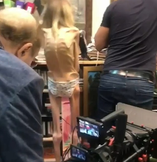 卡里亞金娜嚴重厭食，瘦剩皮包骨。(網圖)