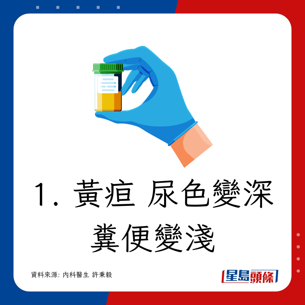 1. 黃疸 尿色變深 糞便變淺